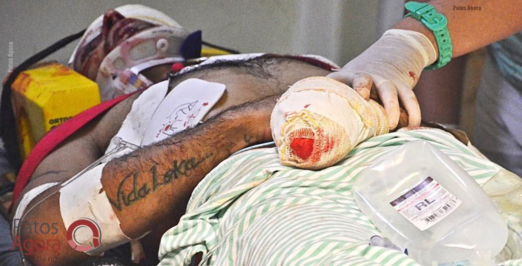 LAGOA FORMOSA: Vítima leva facadas e pauladas e ainda perde parte dos dedos da mão após briga   | Patos Agora - A notícia no seu tempo - https://patosagora.net
