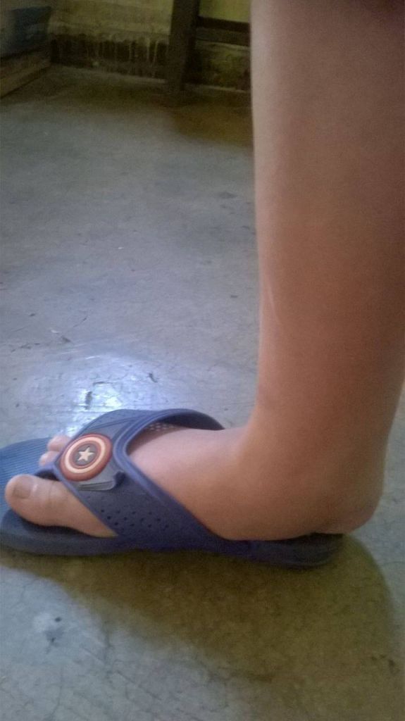 Garoto de 9 anos pode perder movimentos das pernas e família pede ajuda | Patos Agora - A notícia no seu tempo - https://patosagora.net