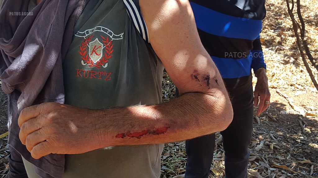 Bandidos invadem fazenda, golpeiam funcionário com machado e fazem proprietário cavar cova | Patos Agora - A notícia no seu tempo - https://patosagora.net