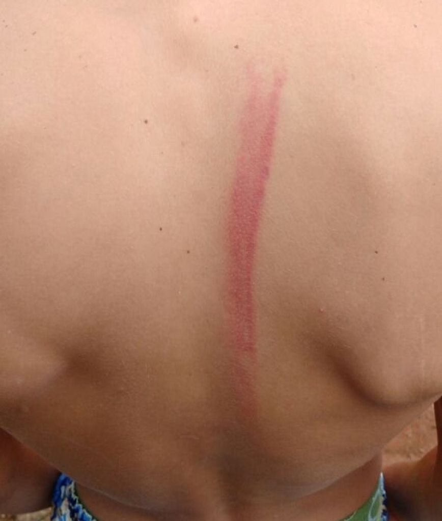 Carmo do Paranaíba: adolescente é agredido com corda e pedrada enquanto andava a cavalo