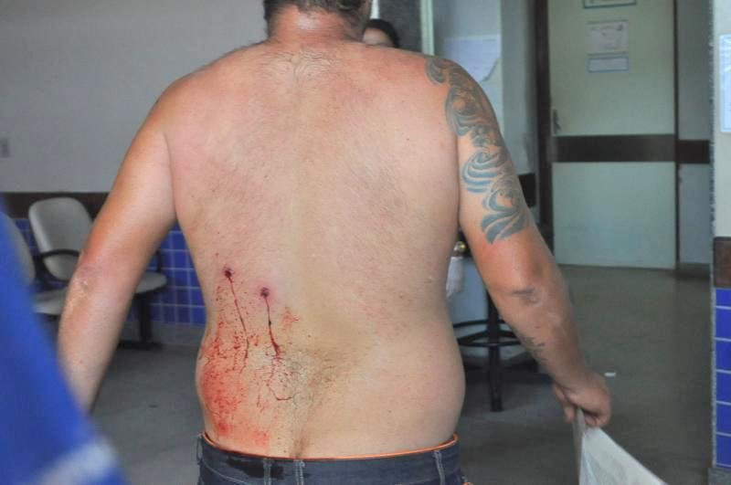 Rapaz é alvejado duas vezes nas costas no bairro Vila Rosa