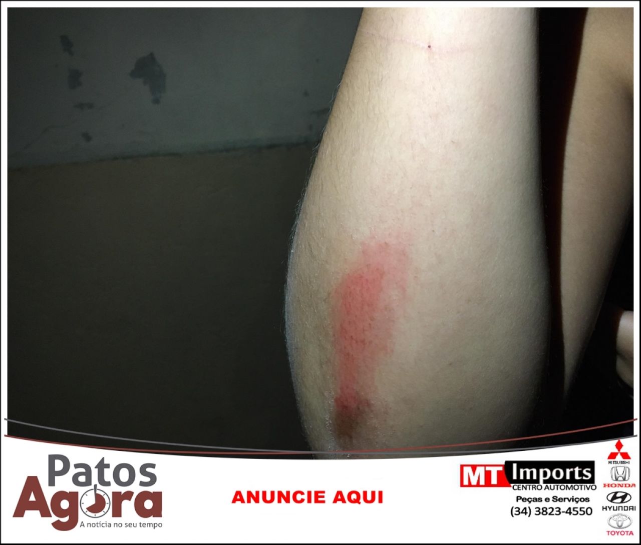 Jovem fica ferida ao ter bolsa puxada por motociclista no Bairro Nova Floresta