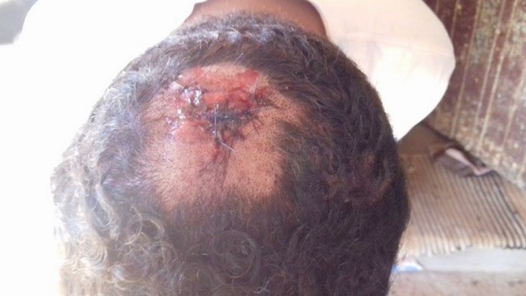 Homem é agredido a pedrada durante assalto em Carmo do Paranaíba