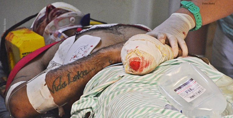 LAGOA FORMOSA: Vítima leva facadas e pauladas e ainda perde parte dos dedos da mão após briga  